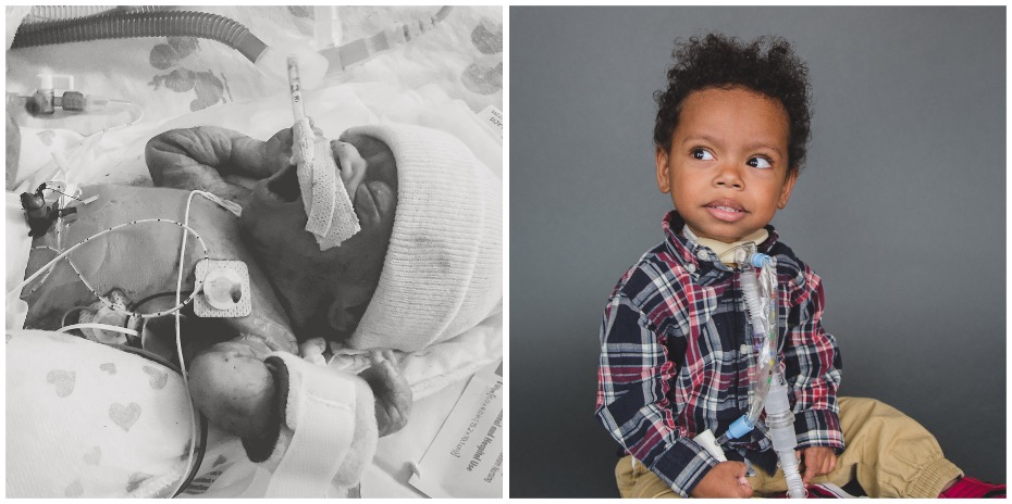 Two photos side-by-side, one black-and-white of a baby yawning while lying in the 博彩网站 Doernbecher Children's Hospital NICU, and the other of a young boy sitting on the floor with a tube connected to his throat.