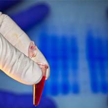 htn-chromosomal