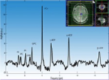Rooney, Sammi: a 7T MR spectrum from the frontal white matter region of the brain (click to enlarge)