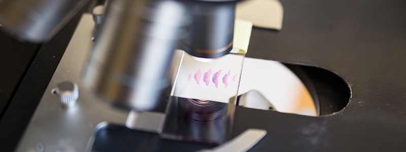 A microscope looking at a skin tissue slide.
