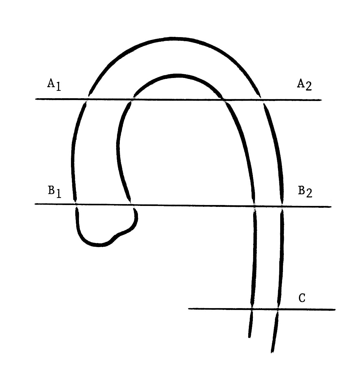 Pediatric Normal Measurements aorta diagram