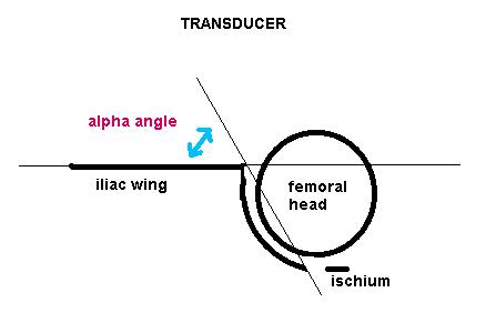 DRAD Pediatric Normal Measurements AP Pelvis Radiograph Alpha Angle