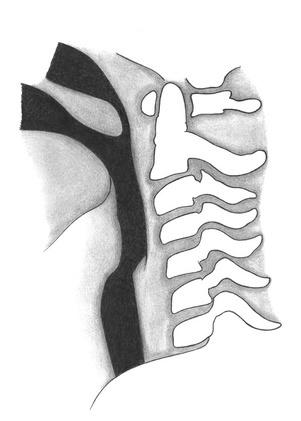 DRAD Pediatric Normal Measurements retropharynx picture
