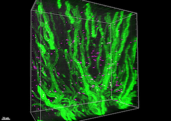 New technique of kidney clearing, showing aquaporin 2 (AQP2) in green and BrdU in purple.