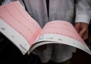 An echocardiogram EKG readout held by a doctor in a white coat