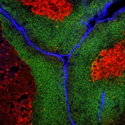 CD31_Hypoxia_CC3-in-PyMT