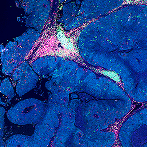 Coussens Lab research image 2