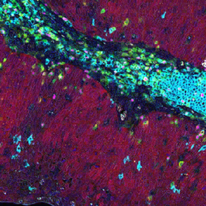 Coussens Lab research image 3