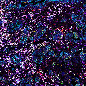 Coussens Lab research image 4