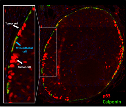 Revised DCIS image