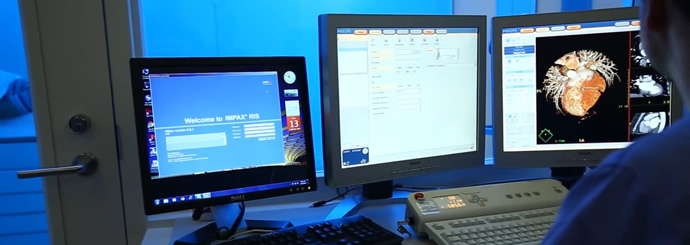 Computer monitors in a dark room showing results of cardiac imaging