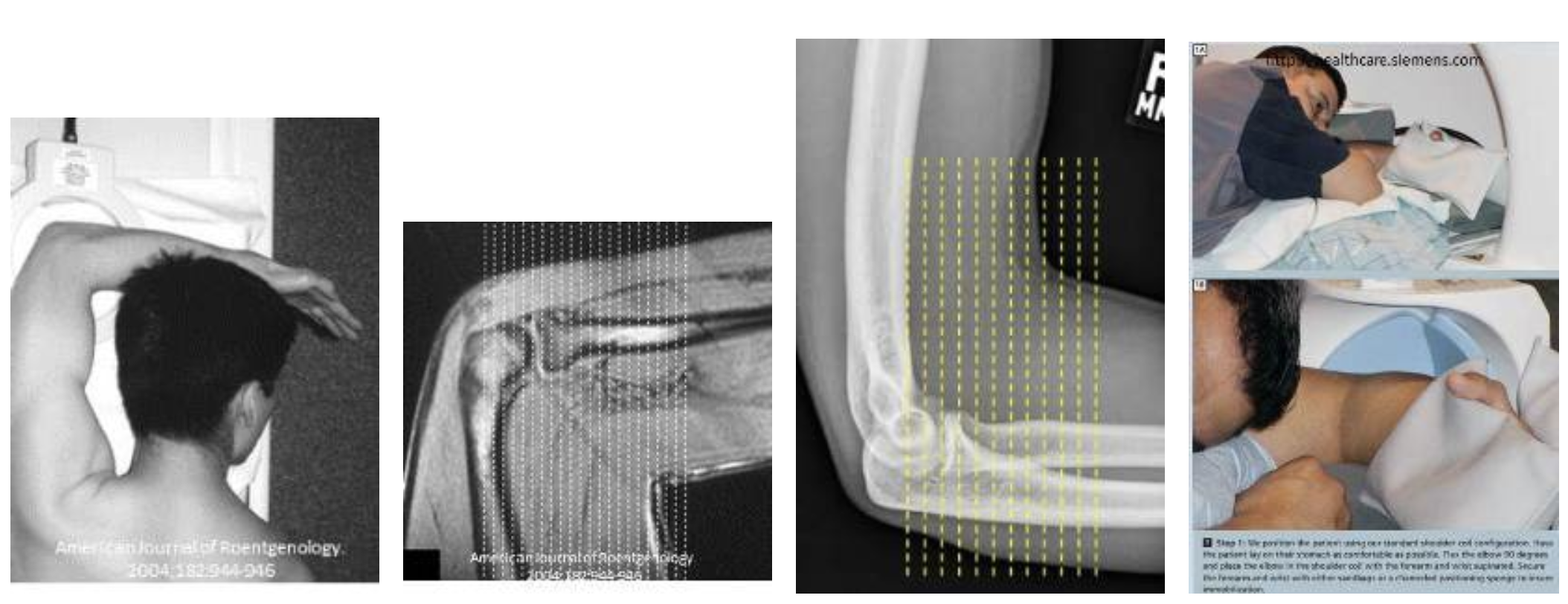 MR Elbow FABS positioning Image for techs