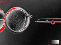 Somatic Cell Nuclear Transfer