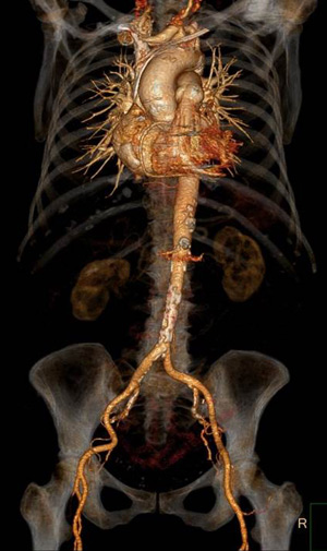 Cardiothoracic for Radiology