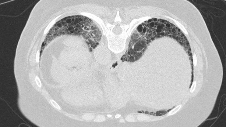 Radiology Chest