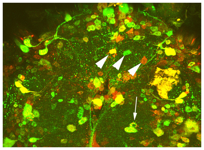Amyloid Precursor Protein Localization