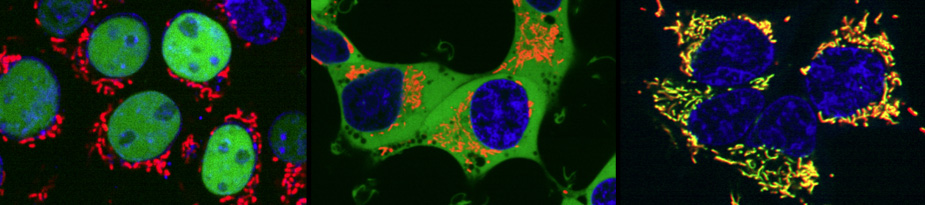 Composite micrograph of nuclear, cytoplasmic and mitochondrial NAD+ concentrations