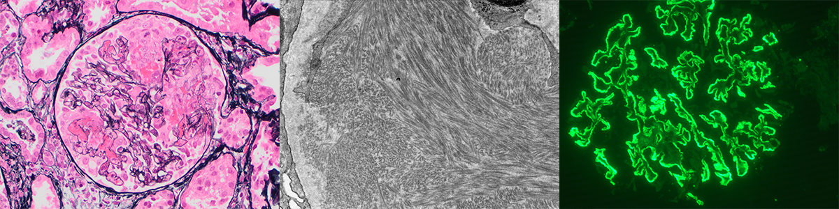 Renal microscope images