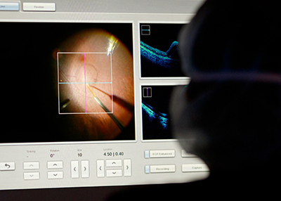 Doctor looking at computer image of gene therapy surgery