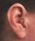 In the canal hearing aid