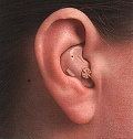In the ear hearing aid
