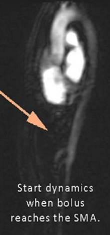 MR Abdomen and Pelvis WWO BODY Protocol image