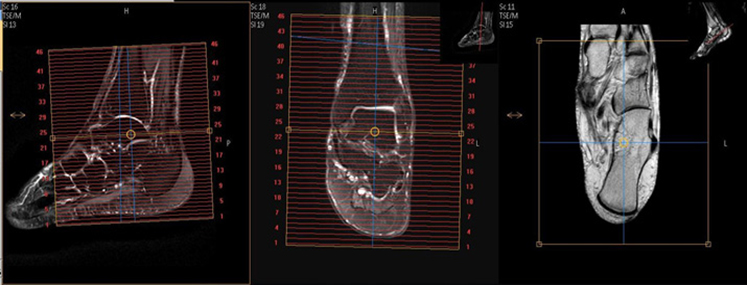 MR Ankle WO Radiology Protocol image 1