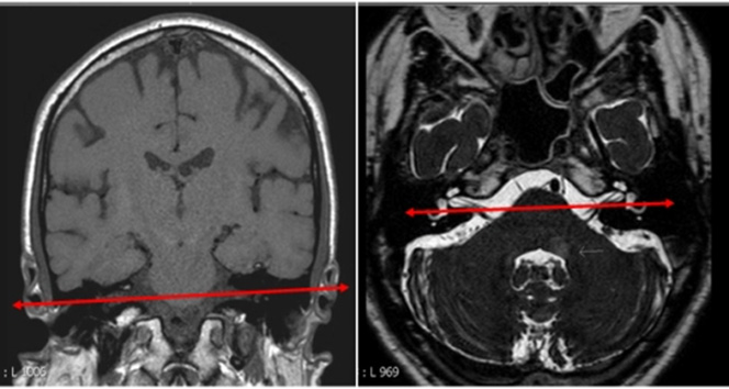 MR IAC WO ENT Protocol image