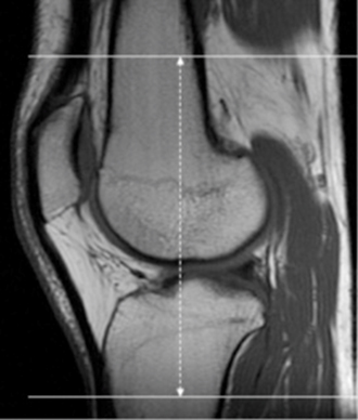 MR Knee WO MSK Protocol image 2