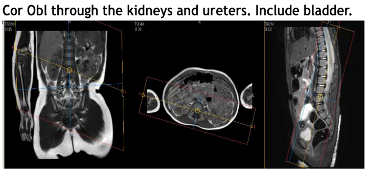 MR Urogram WWO Protocol image