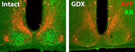 Androgen Receptors