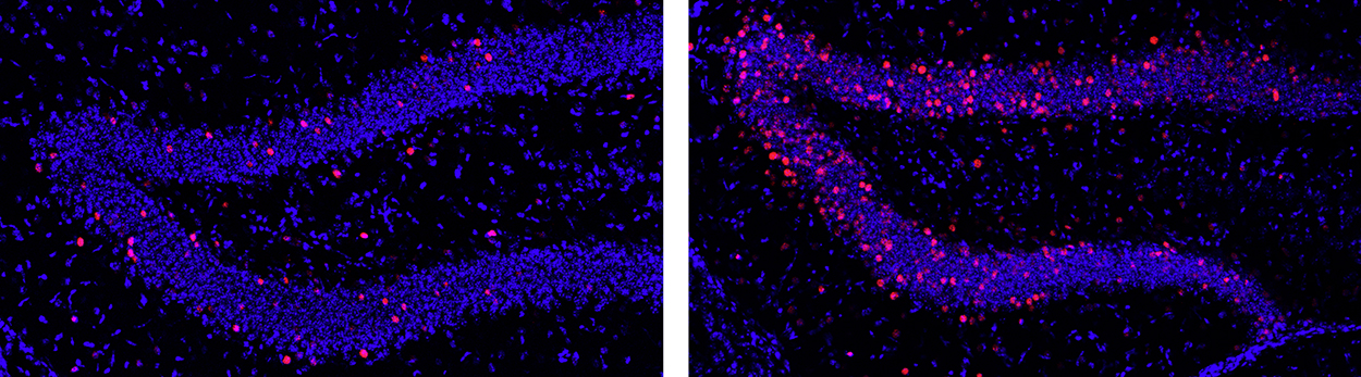 Changes in the mouse hippocampus as a result of exercise