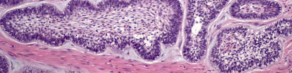 Biopsy Service