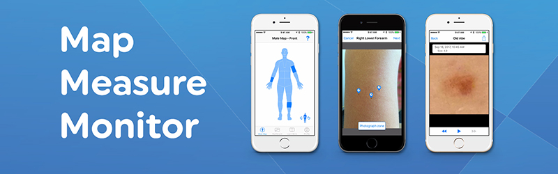 Map, measure, monitor: learn about the MoleMapper™ phone app