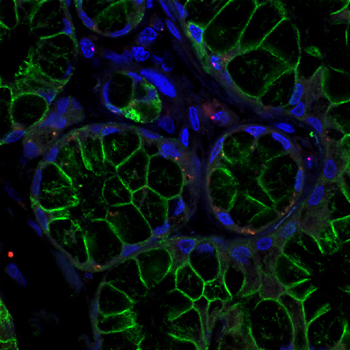 Wong Lab cancer research image.