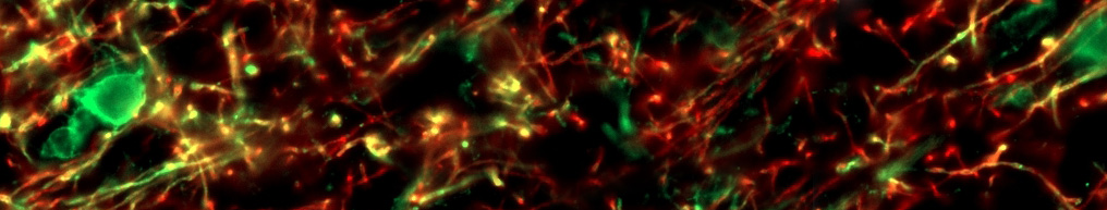 A colorful, very high resolution image of optic nerves