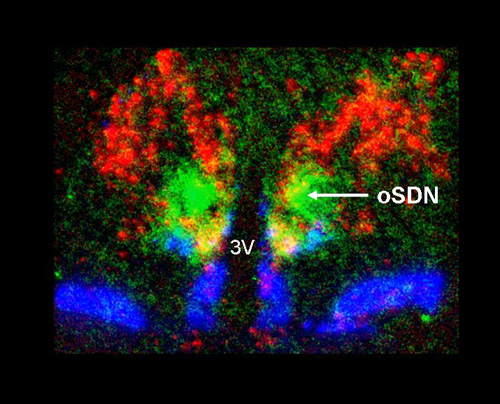 The ovine sexually dimorphic nucleus (oSDN) of the preoptic area