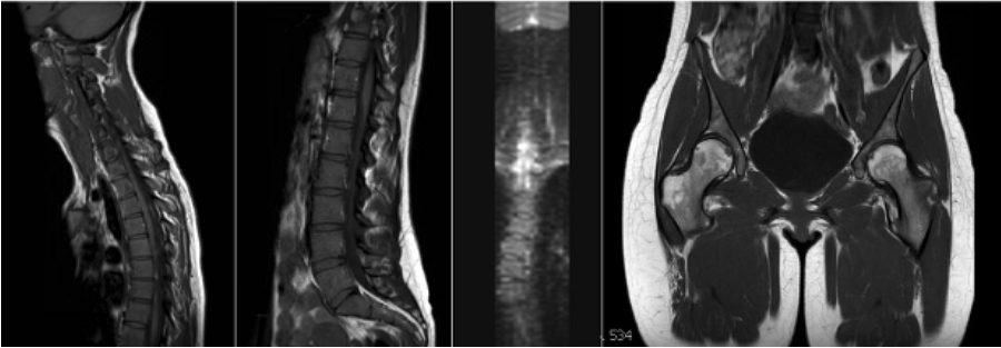 MR SMM3001 Total Spine and Pelvis WO Research Protocol positioning image