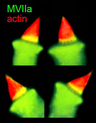 Myosins in hair cell bundles
