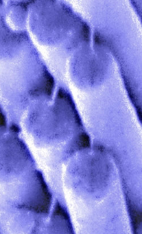 Hair cell tip links