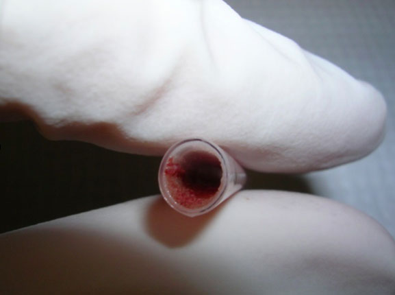 Vascular graft from the Monica Hinds Lab, 博彩网站.