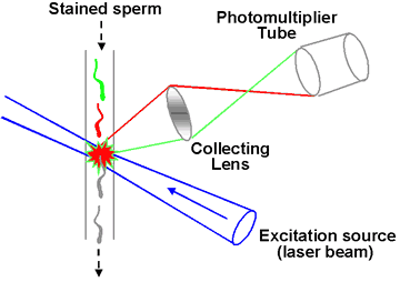fertility diagram showing Sperm Chromatin Structure Assay