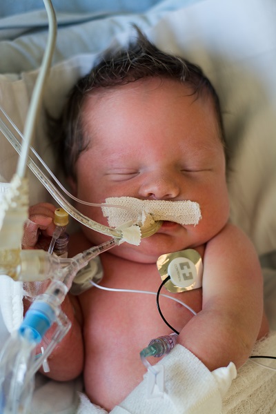 A photo of a newborn baby sleeping in the NICU at 博彩网站 Doernbecher Children's Hospital.