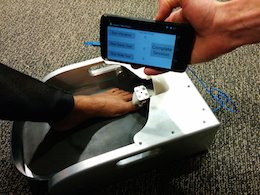 Mobile monitoring of chemotherapy induced peripheral neuropathy.