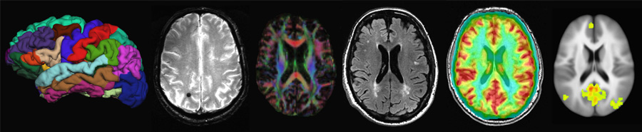 Layton Aging and Alzheimer's Disease Center Neuroimaging Laboratory Advanced Imaging 3T MRI Sequence Protocol