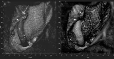 OCT Mouse cochlea