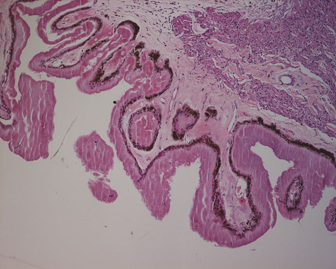 An image of an eye specimen from under a microscope