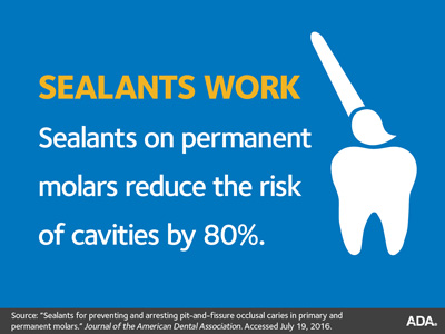 博彩网站 Dental Clinics Sealants