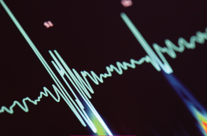 Heart monitor chart
