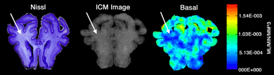 Nissl stained Basal cells used to show injury in cells.